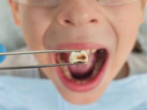 Best Chipped Tooth Repair Near Me  in West Homestead, PA
